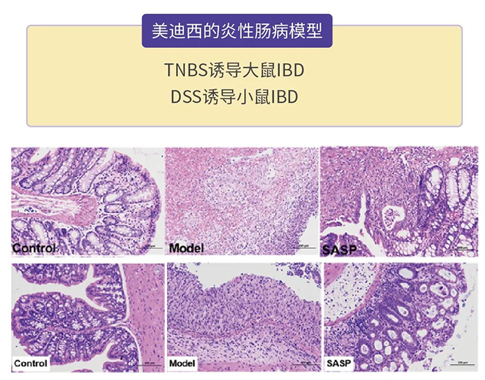 美迪西的炎性腸病模型.png